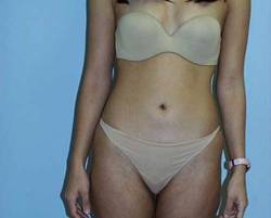After Image: Patient # 25322 - 