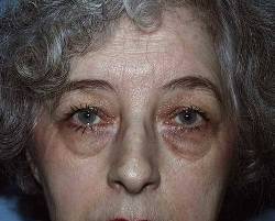 Before Image: Patient # 86576 - 