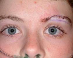 After Image: Patient # 27429 - 