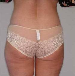 After Image: Patient # 55841 - 