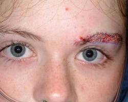 Before Image: Patient # 27429 - 