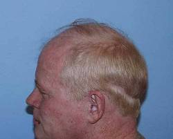 Before Image: Patient # 56242 - 