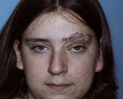 Before Image: Patient # 65694 - 