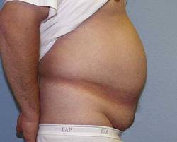 Before Image: Patient # 84231 - 