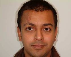 After Image: Patient # 54163 - 