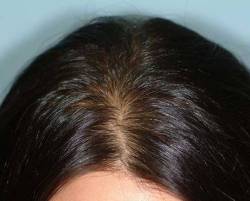 After Image: Patient # 34154 - 