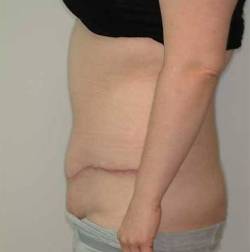 After Image: Patient # 30262 - 