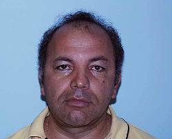 Before Image: Patient # 30986 - 