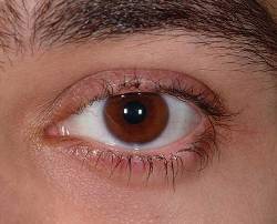 After Image: Patient # 94401 - 