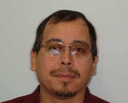 Before Image: Patient # 94035 - 
