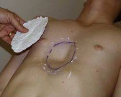 After Image: Patient # 19979 - 