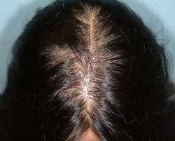 Before Image: Patient # 34154 - 