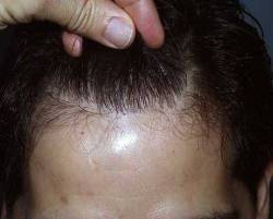 After Image: Patient # 74924 - 