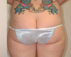 After Image: Patient # 15547 - 