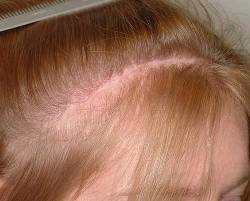 Before Image: Patient # 24673 - 