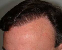 After Image: Patient # 20729 - 