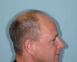 Before Image: Patient # 10068 - 
