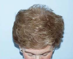 After Image: Patient # 89341 - 