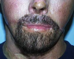 After Image: Patient # 86139 - 