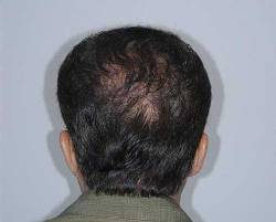 After Image: Patient # 84213 - 