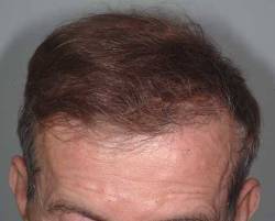 After Image: Patient # 15207 - 