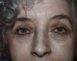 After Image: Patient # 86576 - 