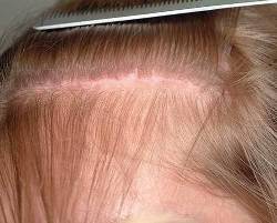 Before Image: Patient # 24673 - 