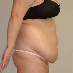 Before Image: Patient # 30262 - 