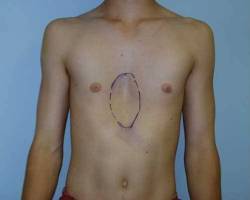 Before Image: Patient # 19979 - 