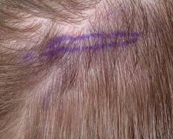 Before Image: Patient # 10992 -