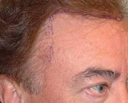 Before Image: Patient # 89786 - 