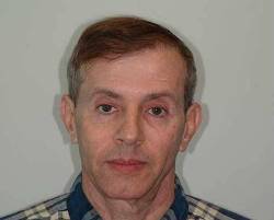 Before Image: Patient # 15207 - 