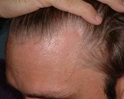 Before Image: Patient # 24703 - 