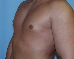 After Image: Patient # 57972 - 