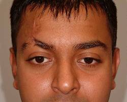 Before Image: Patient # 54163 - 