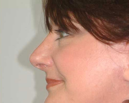 After Image: Patient # 21488 - 