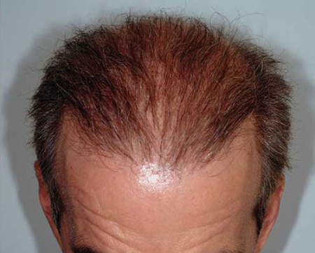 After Image: Patient # 80916 - 