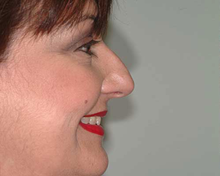 Before Image: Patient # 21488 - 