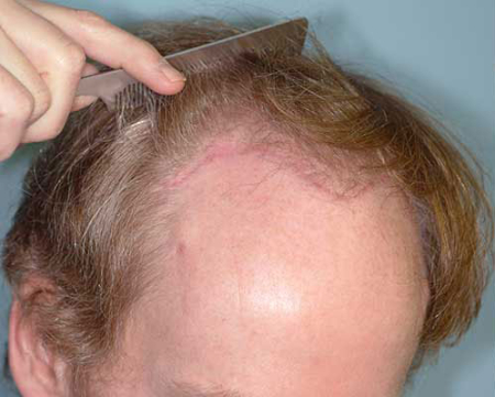 Before Image: Patient # 54834 - 