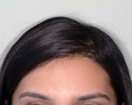 After Image: Patient # 41635 - 