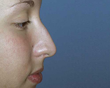 Before Image: Patient # 50999 - 