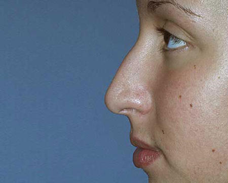Before Image: Patient # 50999 - 