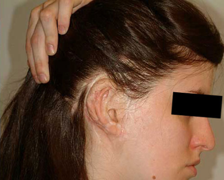 After Image: Patient # 91845 - 