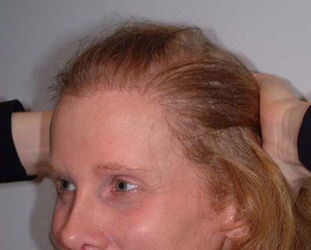 After Image: Patient # 54834 - 