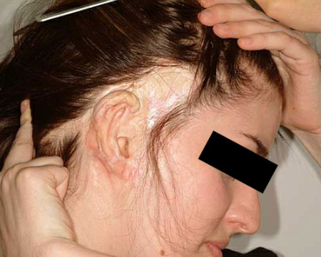 Before Image: Patient # 91845 - 