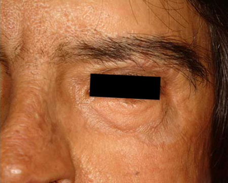 After Image: Patient # 45680 - 
