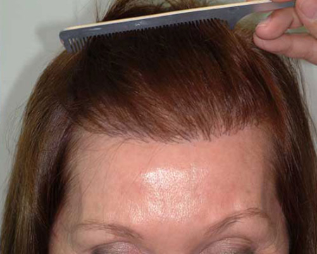 After Image: Patient # 39457 - 