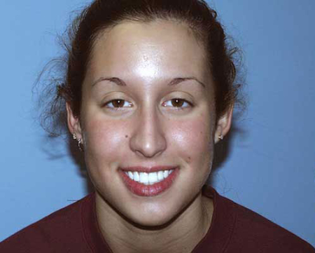 Before Image: Patient # 50999 - 