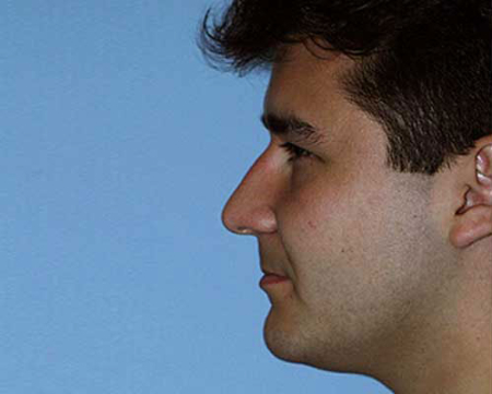 Before Image: Patient # 17926 - 