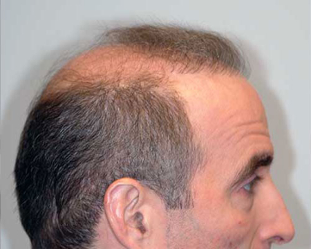 Before Image: Patient # 80916 - 